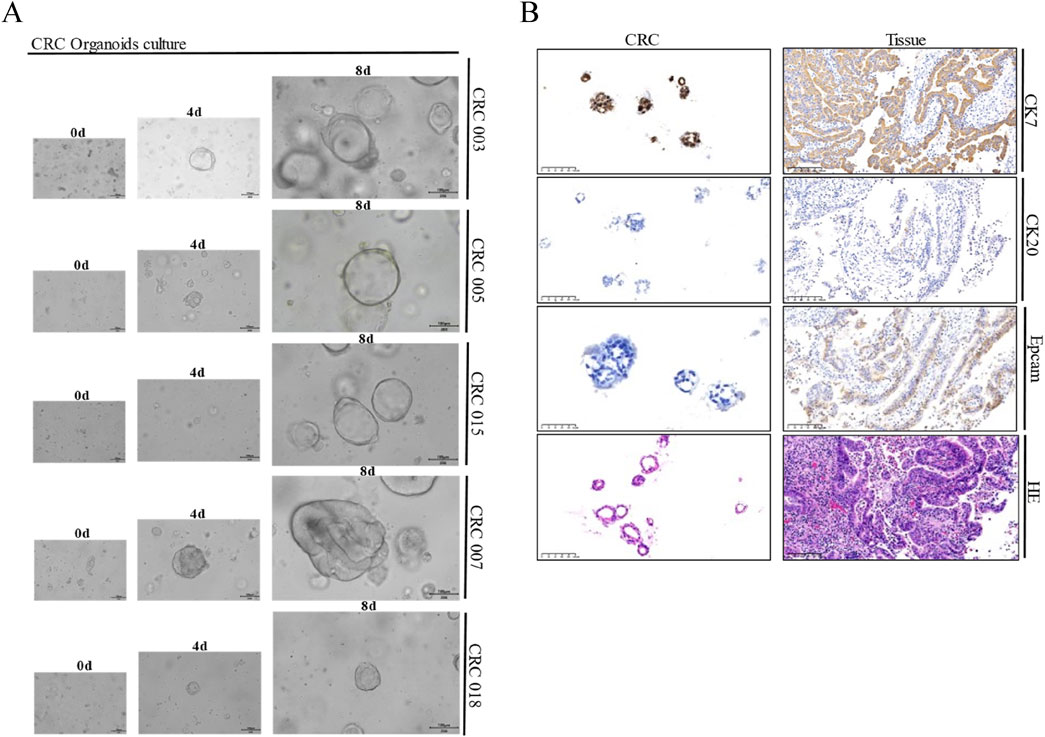 Frontiers | Patient-derived organoids reveal marked