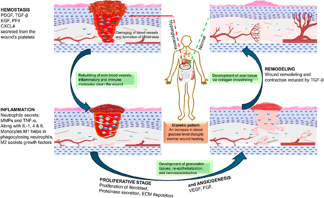 Frontiers Therapies and delivery systems for diabetic wound care