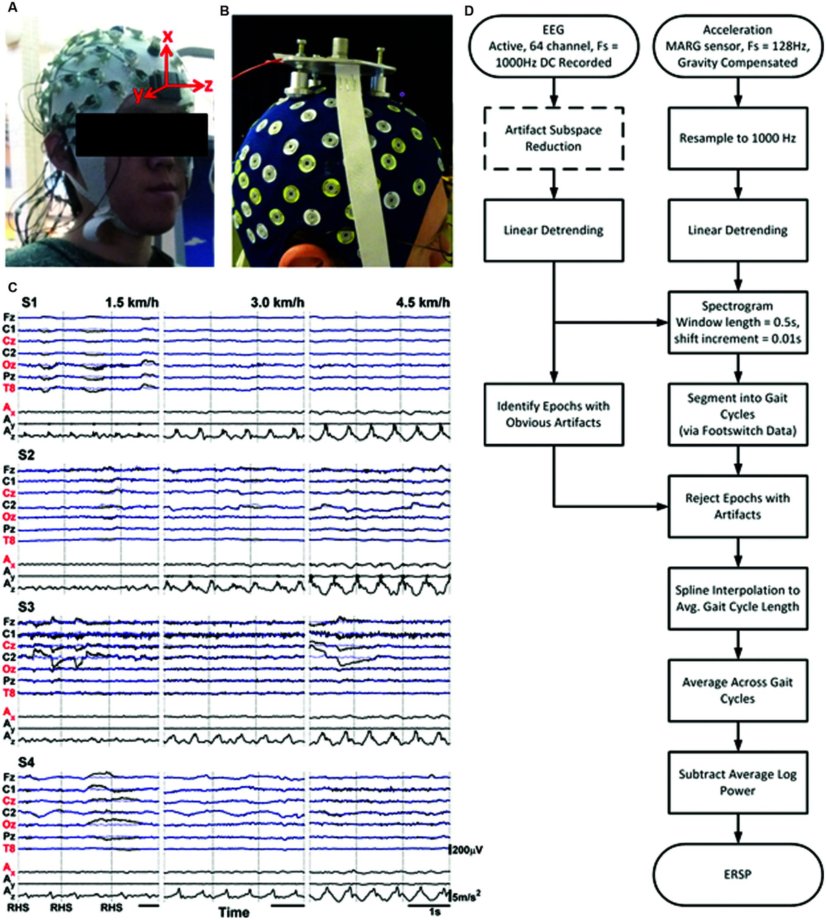 Figure 3. Ancillary EEG demonstrating cortical