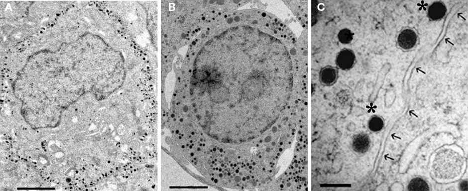 Frontiers | Vesicle Pools: Lessons from Adrenal Chromaffin Cells