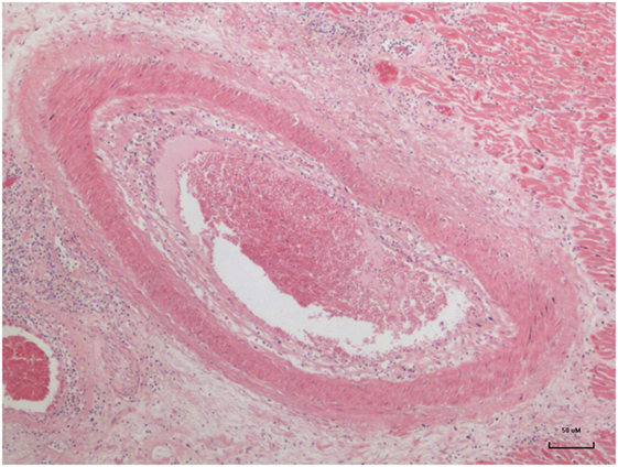 fcvm-03-00030-g001.jpg