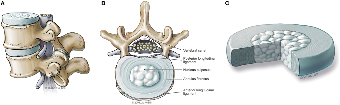 裁断済　脊椎脊髄病学 = PRINCIPLES OF SPINAL DISOR 裁断済 脊椎脊髄病学 = PRINCIPLES OF SPINAL DISOR 裁断済 脊椎