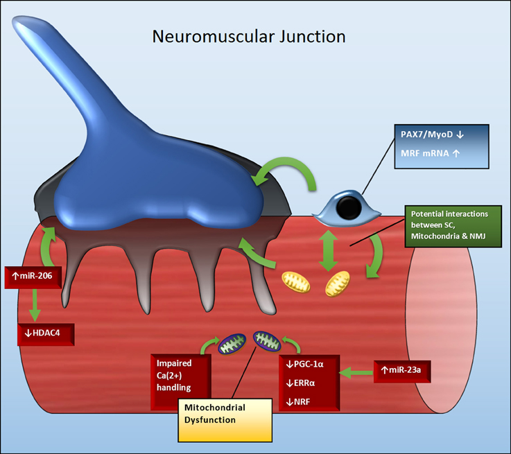 Muscle Diseases (神経学) ALS - Wikipedia