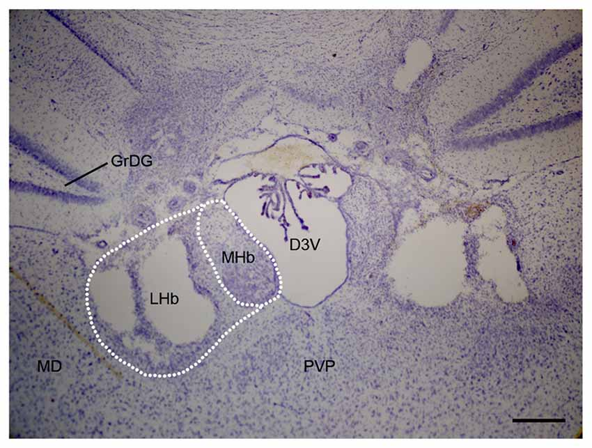 Stria medullaris innervation follows the transcriptomic
