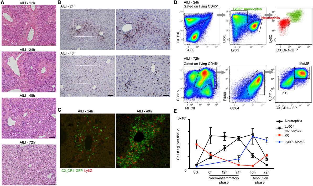 Frontiers | Ly6Chi Monocytes and Their Macrophage