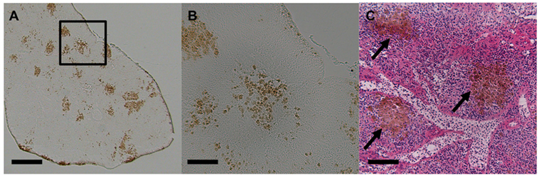 Frontiers Melanomacrophage Centers As a Histological Indicator of