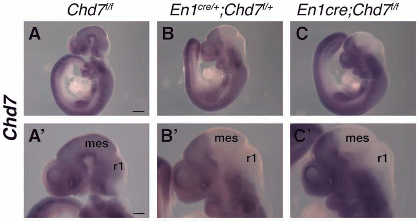 Frontiers | Cerebellar Vermis and Midbrain Hypoplasia Upon