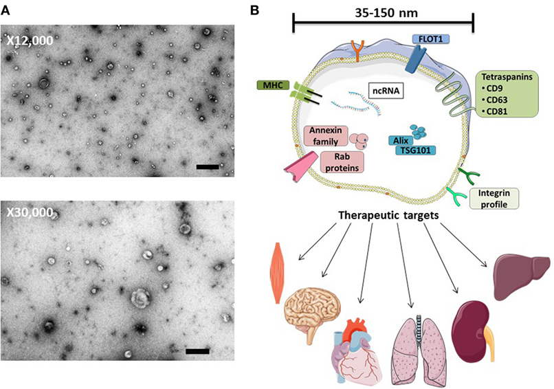 Frontiers | Toward Exosome-Based Therapeutics: Isolation