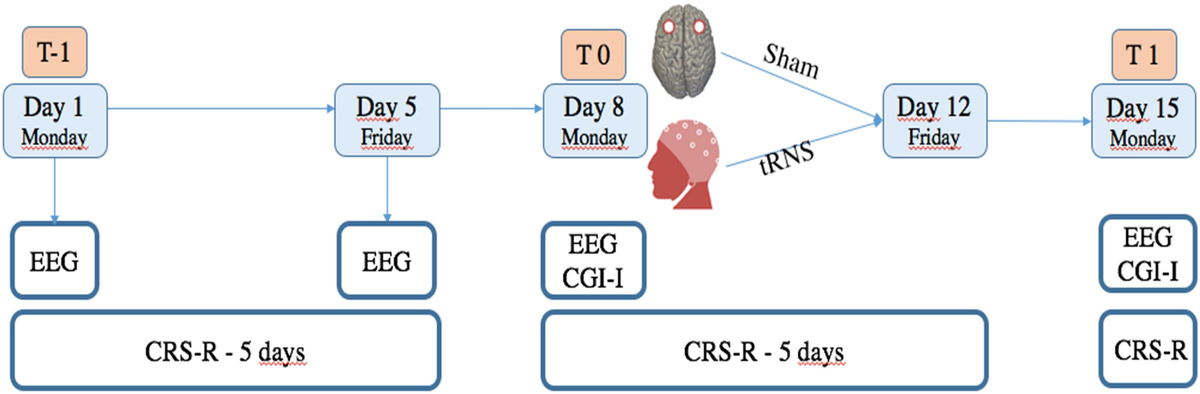 Frontiers | Transcranial Random Noise Stimulation Does Not Improve ...