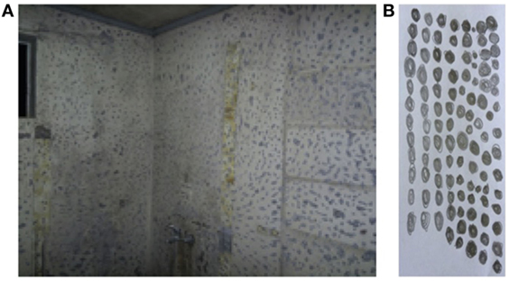 Trypophobia: What Do We Know So Far? A Case Report and ... - Frontiers
