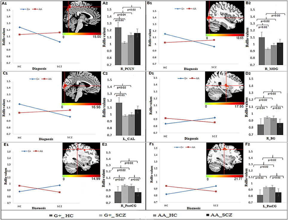 【超お買い得！】 | Frontiers Effects Resting-State on Polymorphisms DISC1 of アイドルグッズ