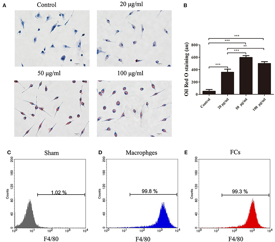 Frontiers | Macrophage Foam Cell-Targeting Immunization Frontiers | Macrophage Foam Cell-Targeting Immunization