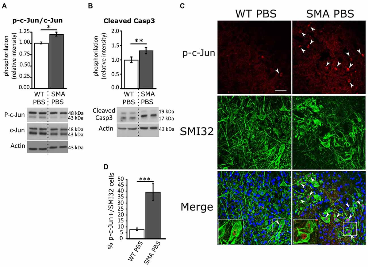 絶対的な信頼 Frontiers (JNK Kinase NH2-Terminal c-Jun Pharmacological | アイドル