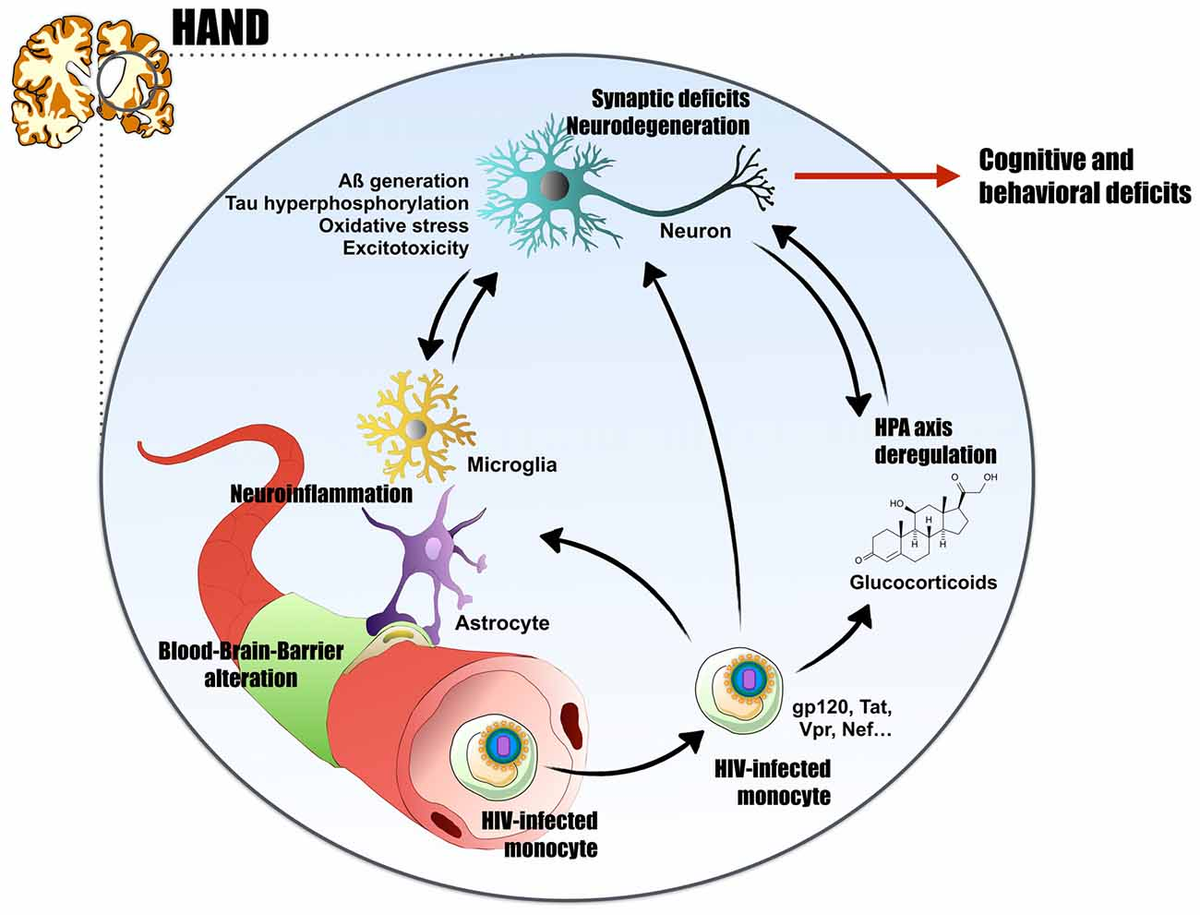 Frontiers | HIV Neuroinfection and Alzheimer's Disease