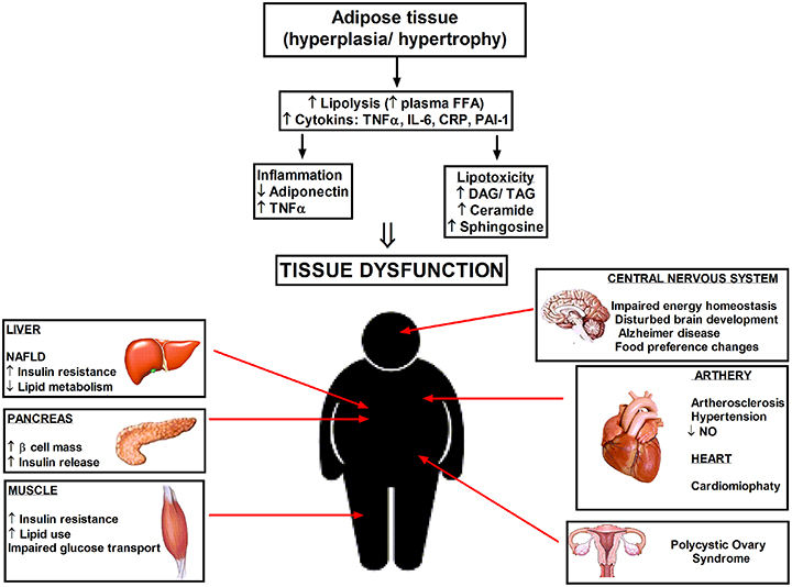 Š Frontiers | The Role of Ceramides in Insulin Resistance