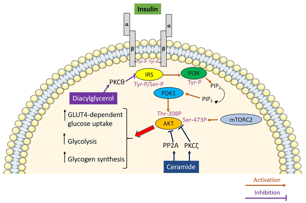 Cellular-level view of insulin resistance