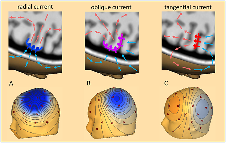 Repetitive transcranial magnetic stimulation modulates brain