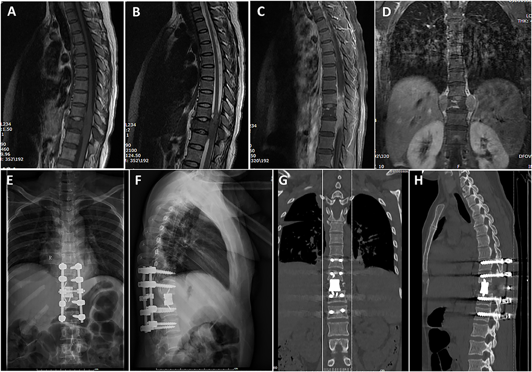 健康・医学 Thoracic Tumours 健康・医学 Thoracic Tumours WHO Classification of Tumours