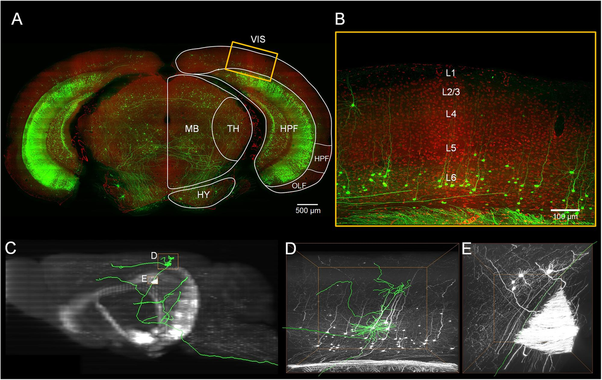 Frontiers | Pinpointing Morphology and Projection of