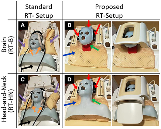 Frontiers | Brain and Head-and-Neck MRI in Immobilization