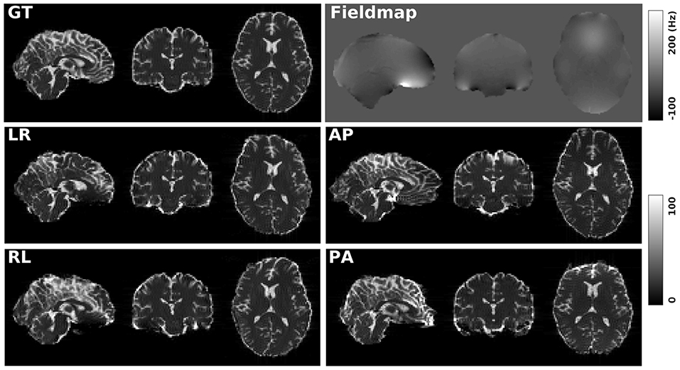 MRI 一問一答 MRI一問一答: 撮像法選択と読影に“必ず”役立つ基礎知識 | 平井
