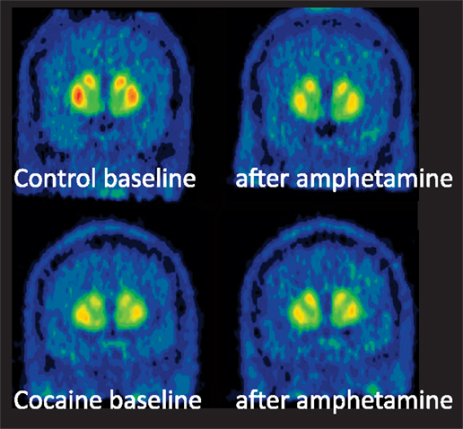 新発売 Receptor Kappa-Opioid | Frontiers Signaling Striatum the in 下着・アンダーウェア