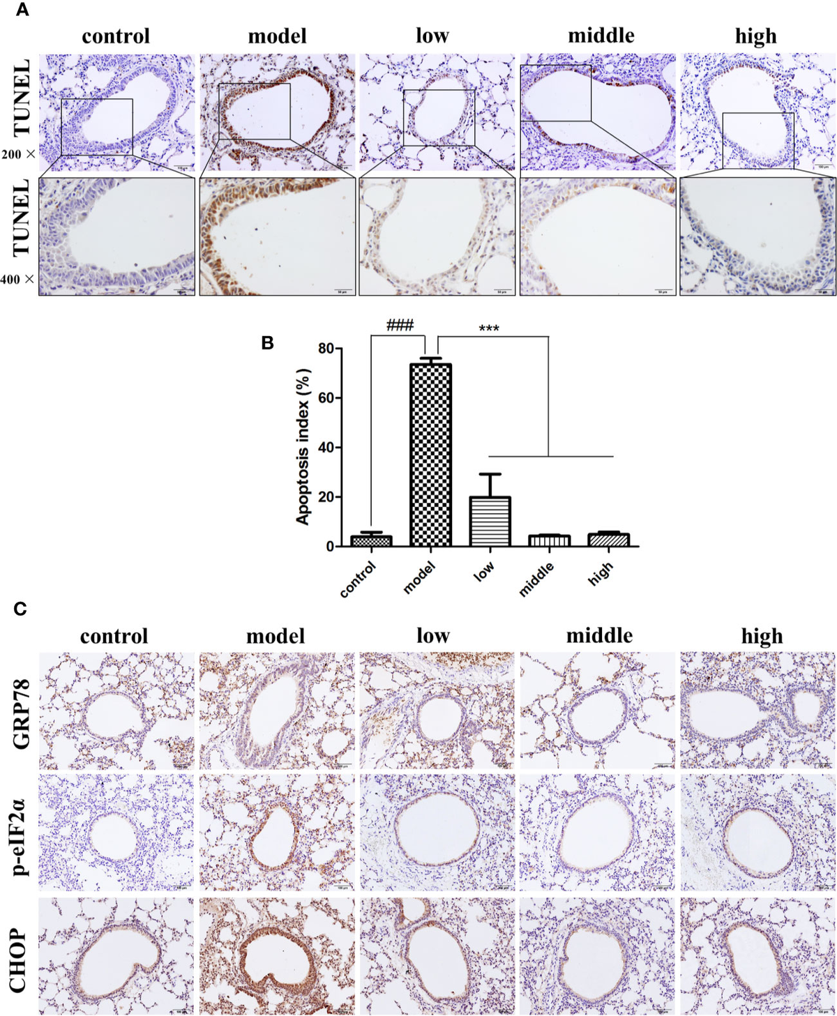 Frontiers | Jianpiyifei II Granules Suppress Apoptosis of