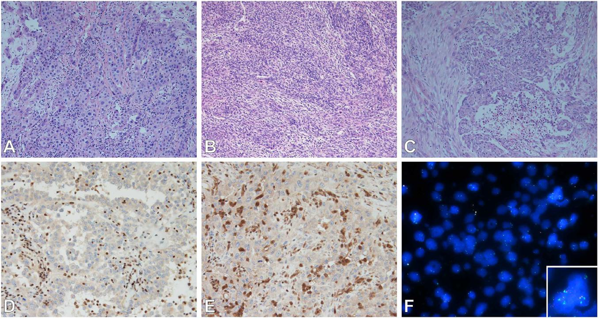Frontiers | The Use of Immunohistochemistry, Fluorescence in