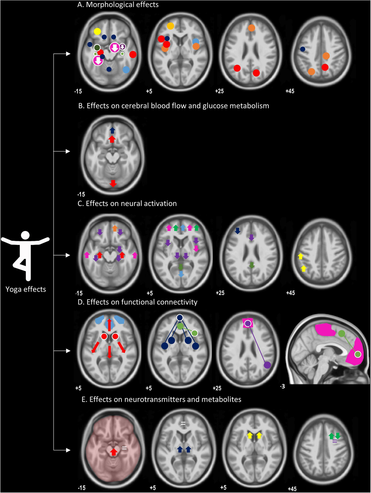 The Future Of Neuroscience: Kip Kingle'S Brain Scan - cehmifw