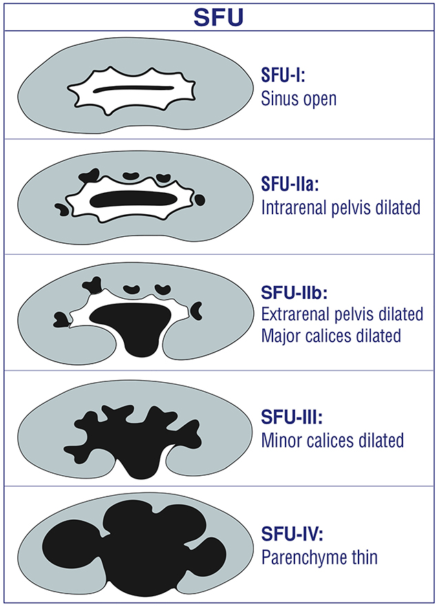Frontiers Grading Of Hydronephrosis An Ongoing Challenge frontiers-grading-of-hydronephrosis-an-ongoing-challenge