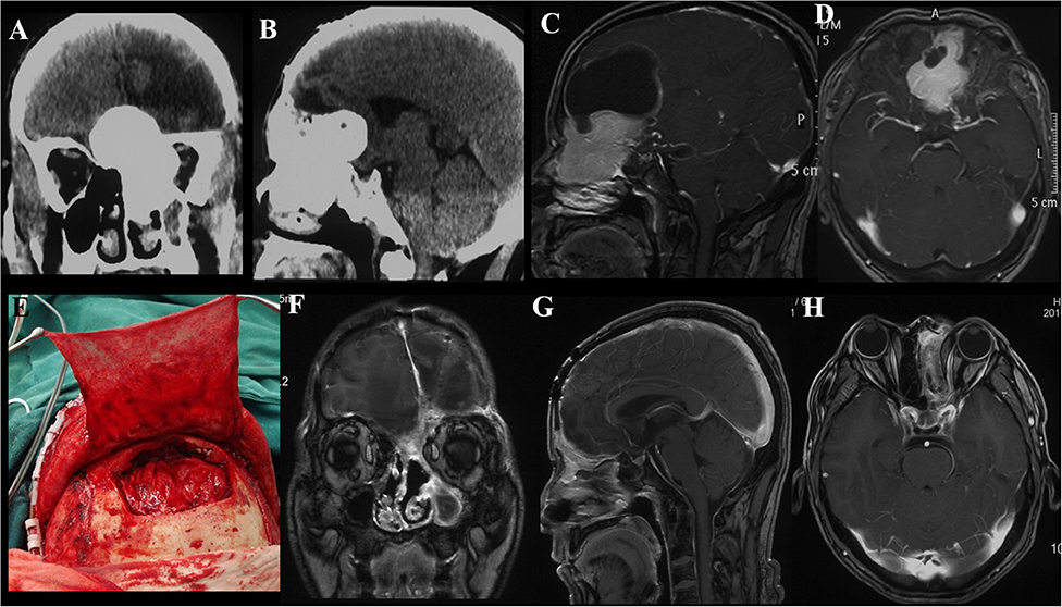 Frontiers | Clinial Features, Individualized Treatment and