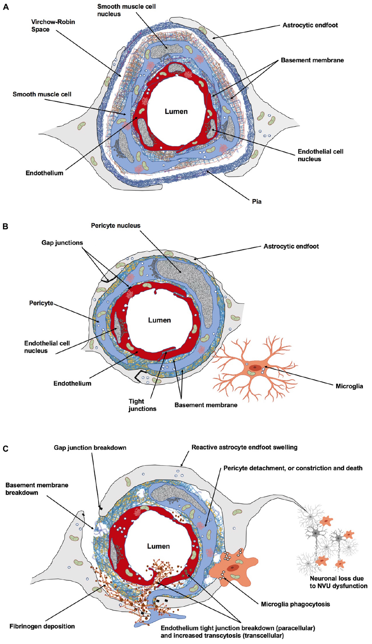 Frontiers | Structural and Functional Remodeling of the Brain Vasculature  Following Stroke, image size:1200x2078