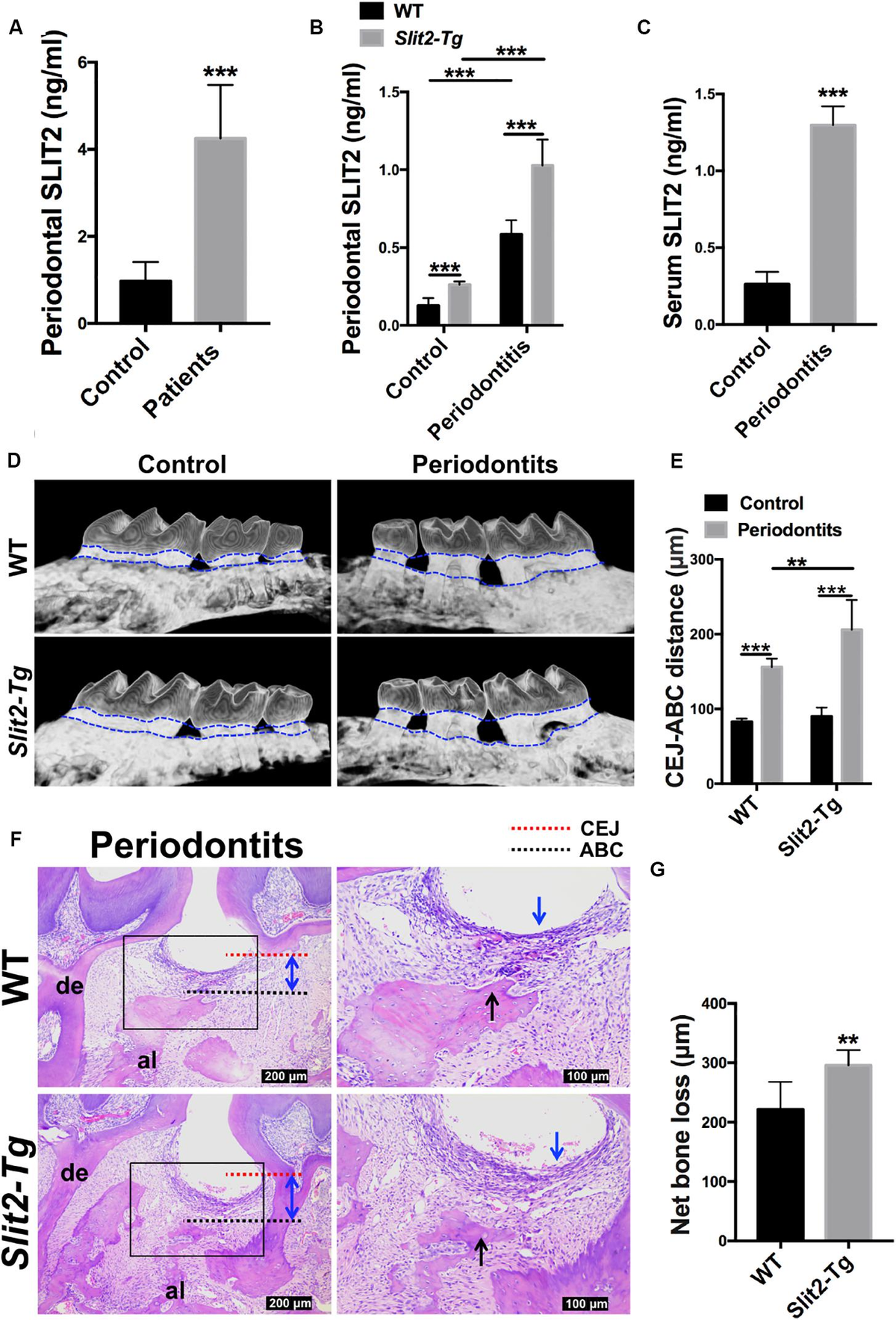 Frontiers | SLIT2 Overexpression in Periodontitis