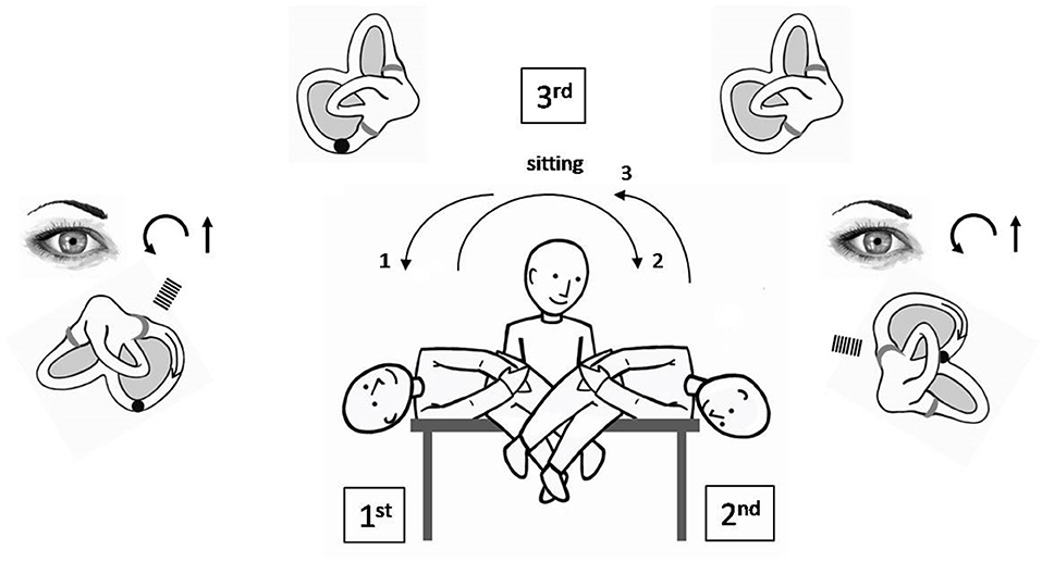 特価商品  Frontiers | Congruous Torsional Down Beating Nystagmus in 健康・医学