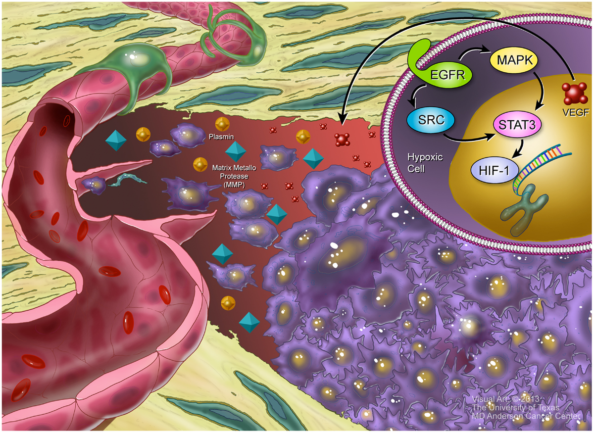 通販生活 ファッション | Frontiers Understanding from Sarcoma Bone of Biology the ギター