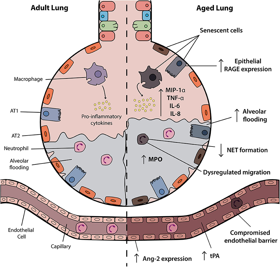Frontiers | The Impact of Aging in Acute Respiratory