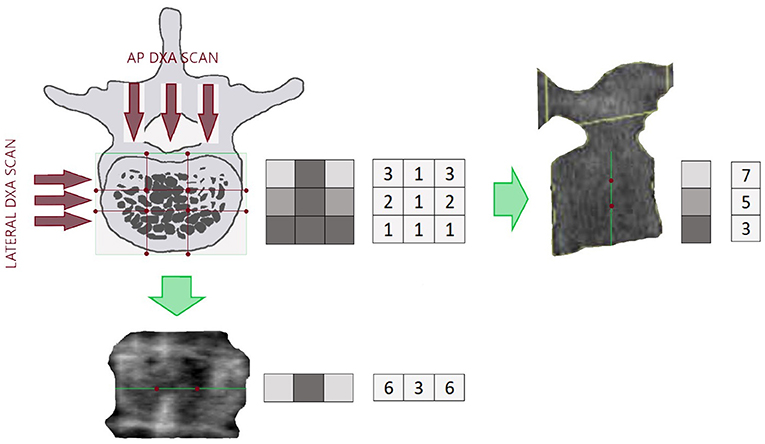 Audible disease FRACTURE FR-1 トレモロ Audible disease FRACTURE FR-1 トレモロ 2025年最新】Audible