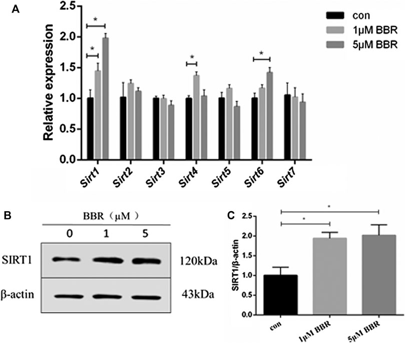 Frontiers | Adipose Tissue SIRT1 Regulates Insulin