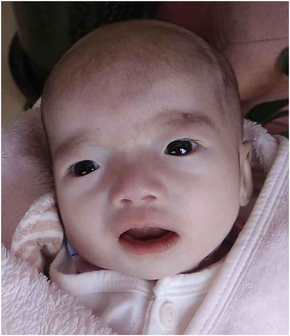 Frontiers | Case Report: Clinical Description of a Patient