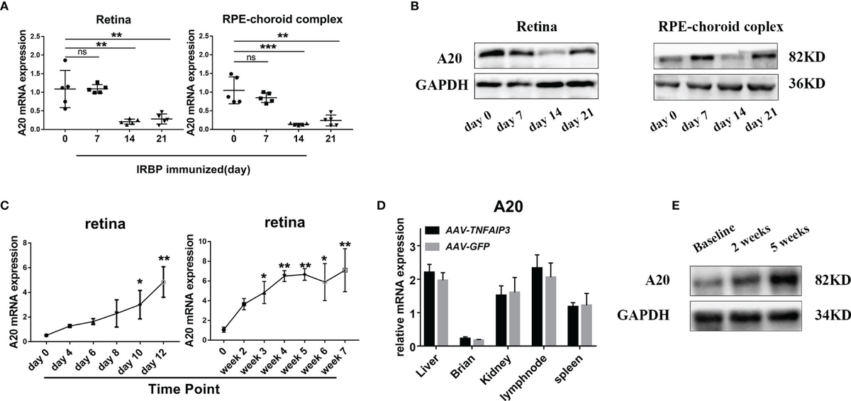無料発送 A20 | Frontiers Inhibits by Mice in Inflammation Intraocular シングルベッド