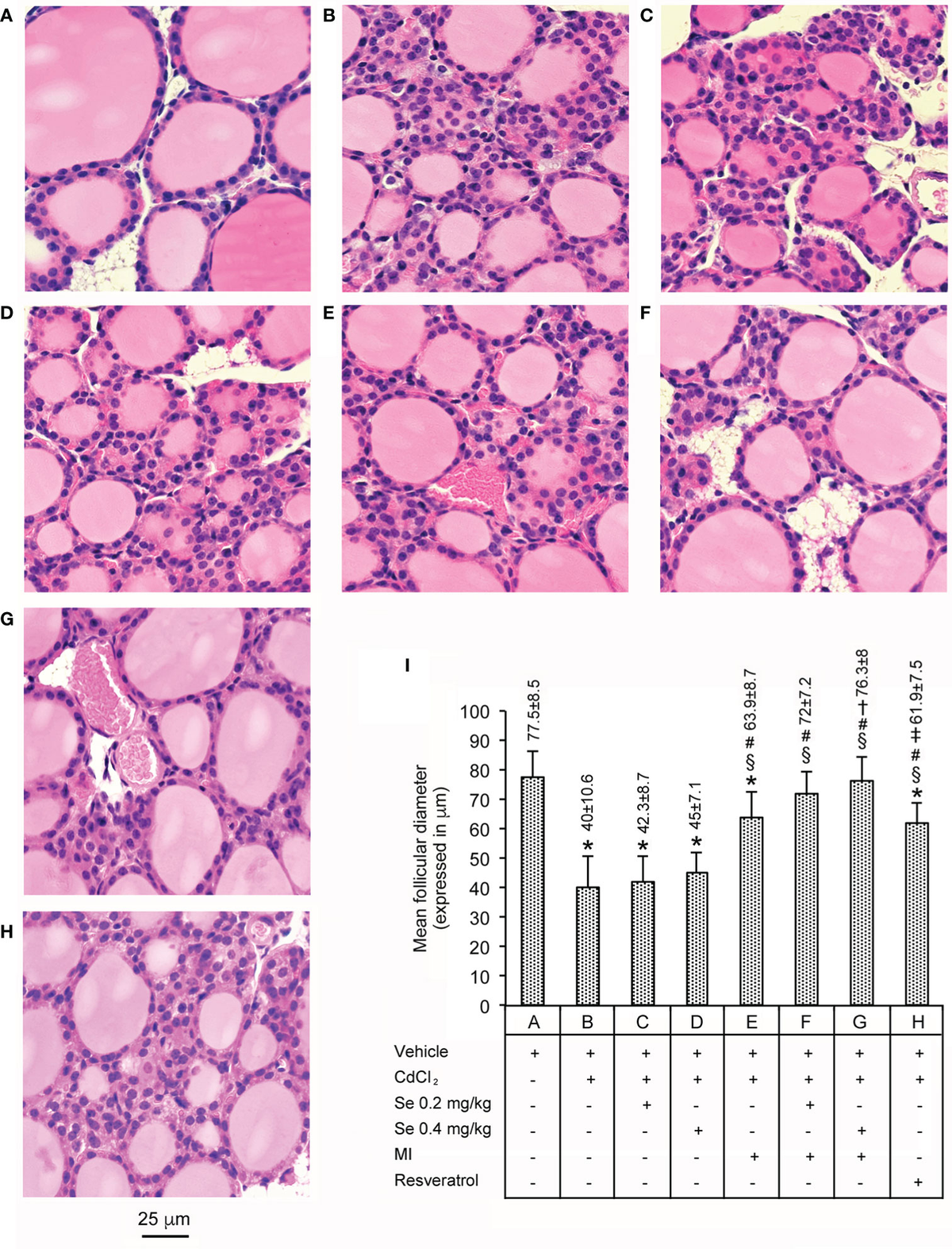 Frontiers | The Association of Myo-Inositol and Selenium Contrasts  Cadmium-Induced Thyroid C Cell Hyperplasia and Hypertrophy in Mice
