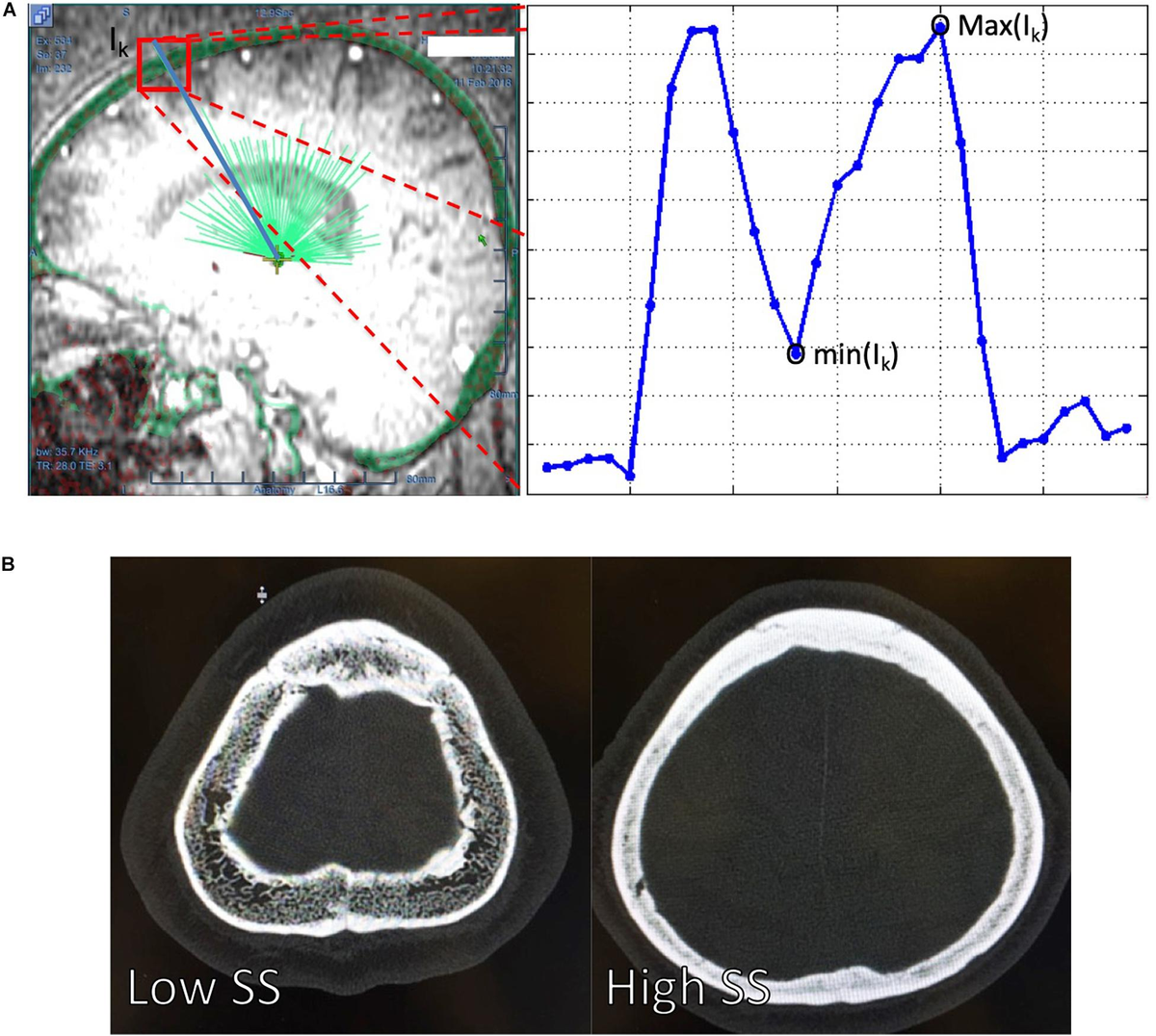 裁断済 Diagnostic Imaging: Musculoskeletal Diagnostic Imaging: Musculoskeletal Non-Traumatic Disease