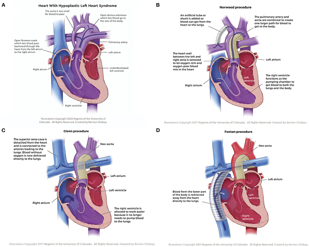 Frontiers Review on Mechanical Support and CellBased Therapies for