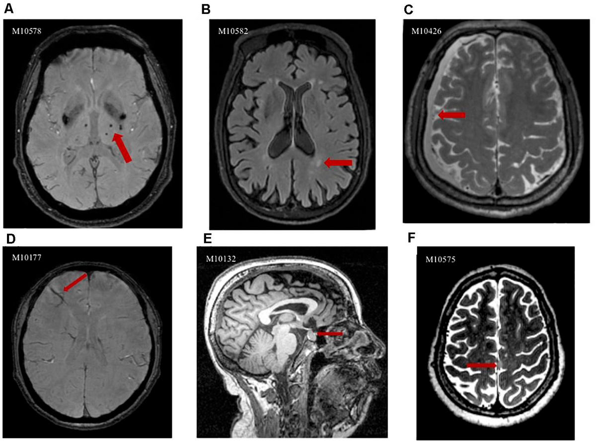 Frontiers | Incidental Brain Magnetic Resonance Imaging