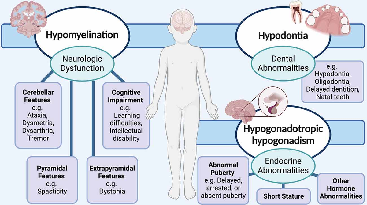 Frontiers | POLR3-Related Leukodystrophy: Exploring Potential Therapeutic  Approaches, image size:1200x669