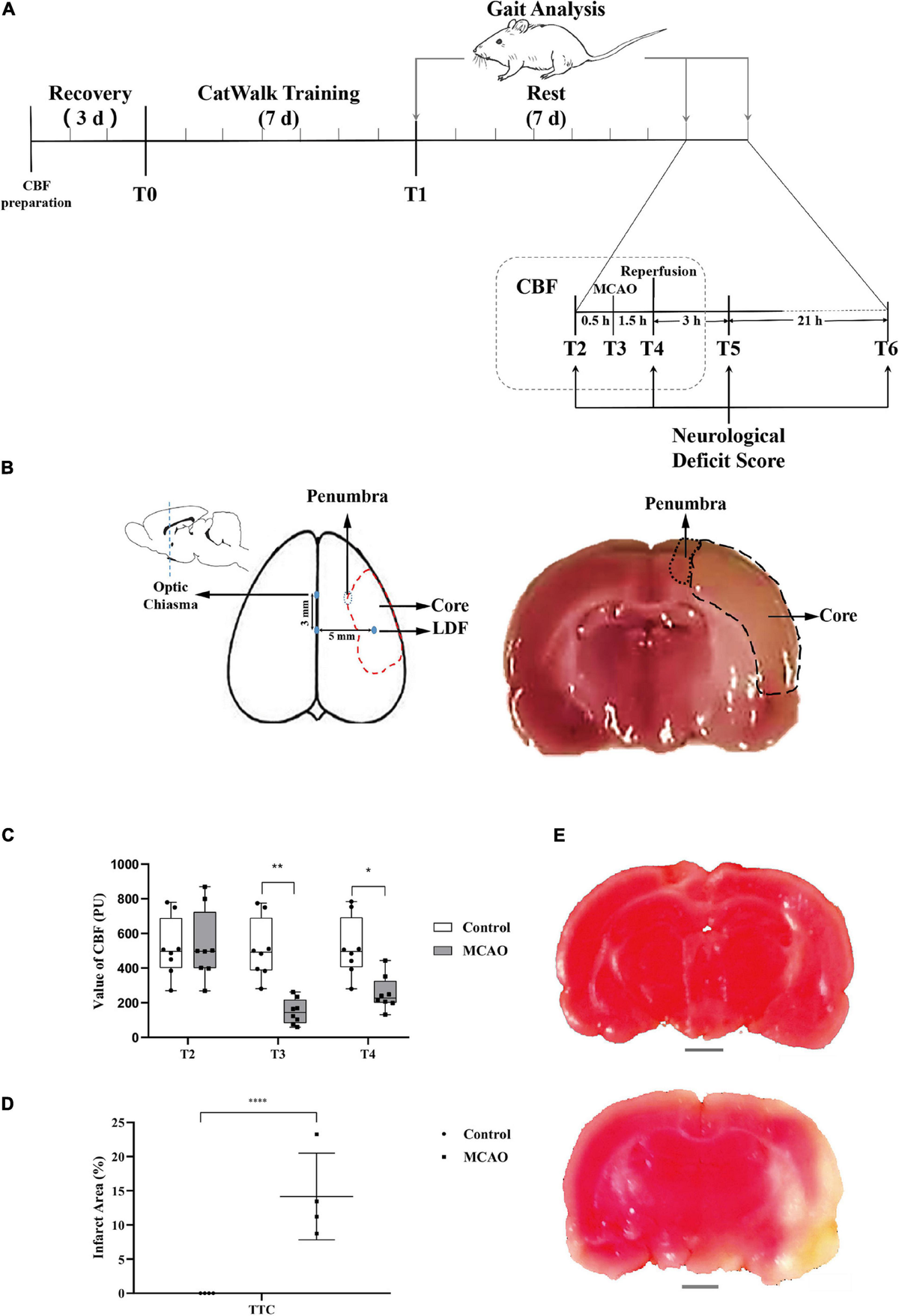 【即納】 Ischemia-Reperfusion Cerebral | Frontiers Is With Associated テーブル・チェア・ハンモック