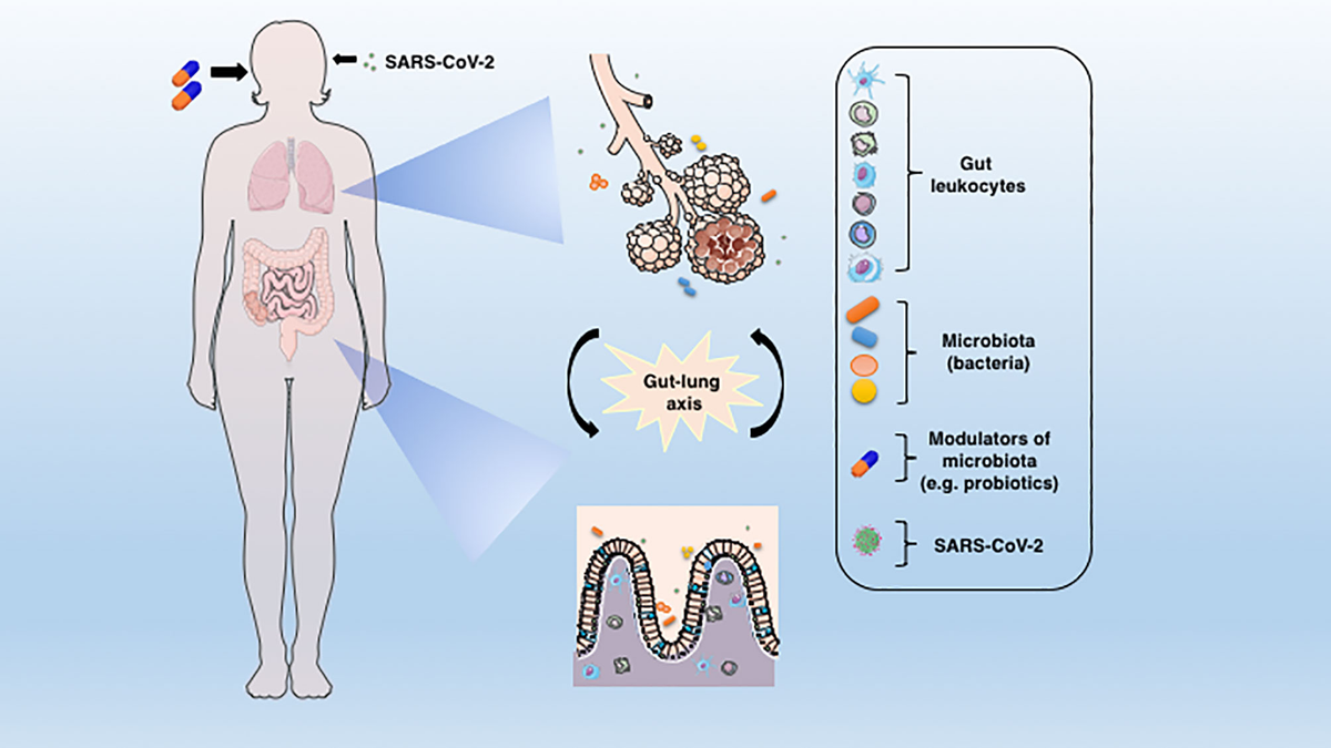 Frontiers | Microbiota Modulation of the Gut-Lung Axis in