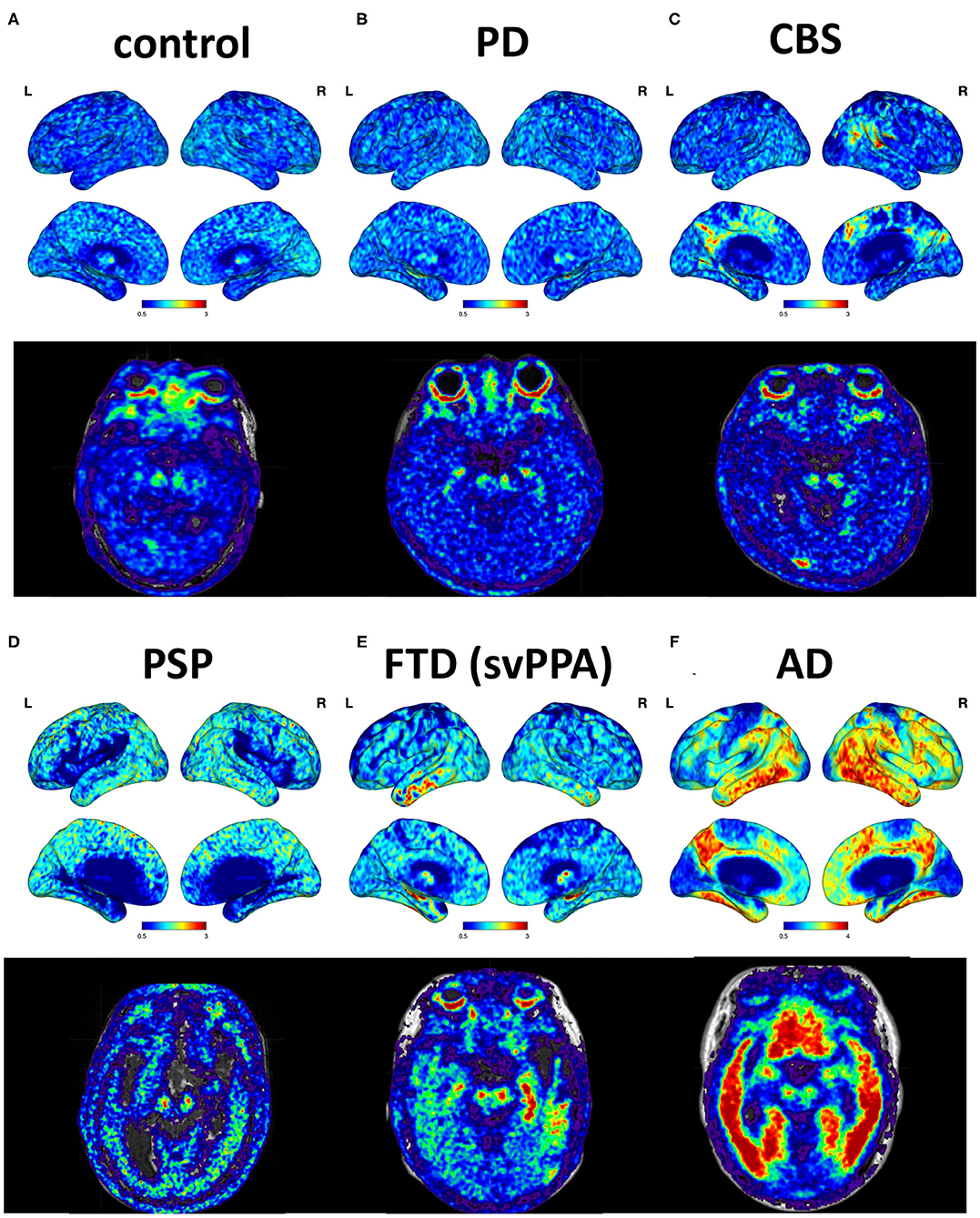 Frontiers | Integrated 18F-T807 Tau PET, Structural MRI, and