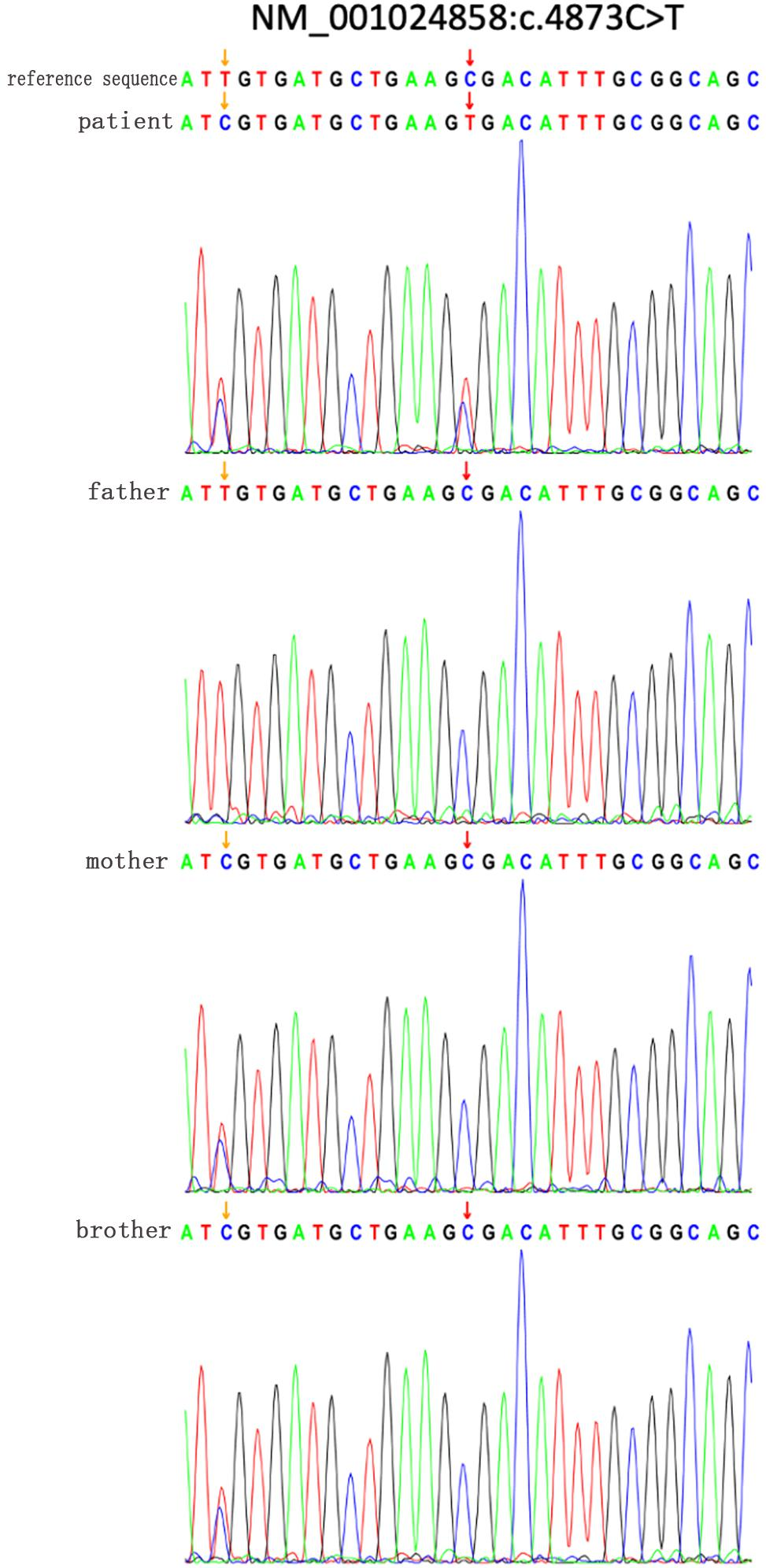 Frontiers | Preliminary Study on the Clinical and Genetic Frontiers | Preliminary Study on the Clinical and Genetic
