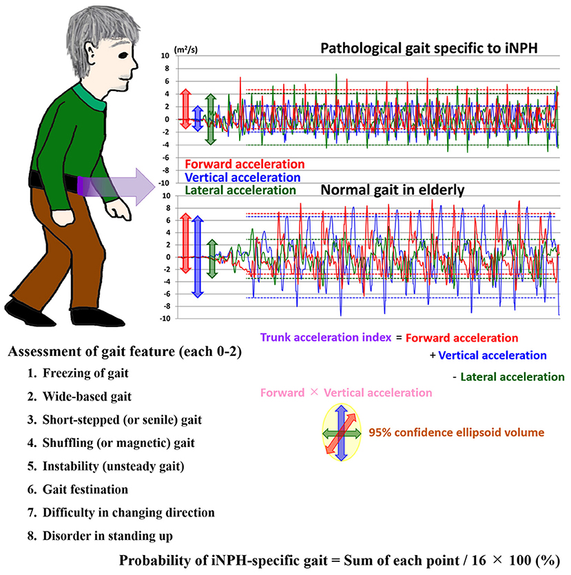 Amazon.com: Gait Analysis: Normal and Pathological Function